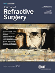 Journal of Refractive Surgery - Octubre 2017