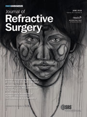 Journal of Refractive Surgery - Junio 2018